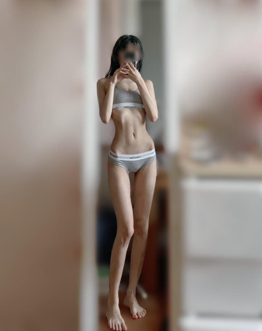 머꼴